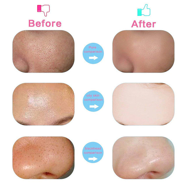 5 in 1 - Facial Electric Cleanser & Massager - Trendy Crate Pk