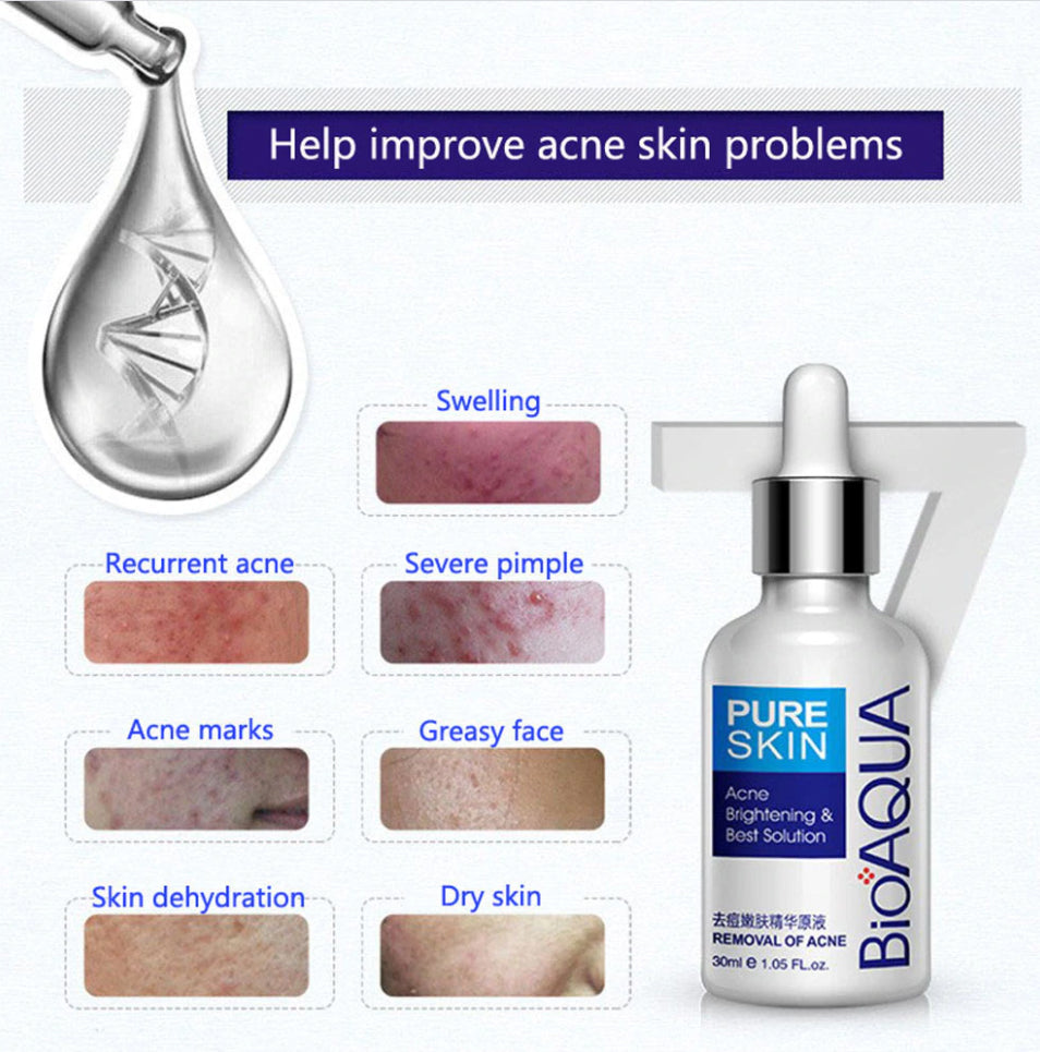 BIOAQUA Skin Care Acne Face Treatment 4 in 1 Acne Series (With Free Sheet Mask) - Trendy Crate Pk