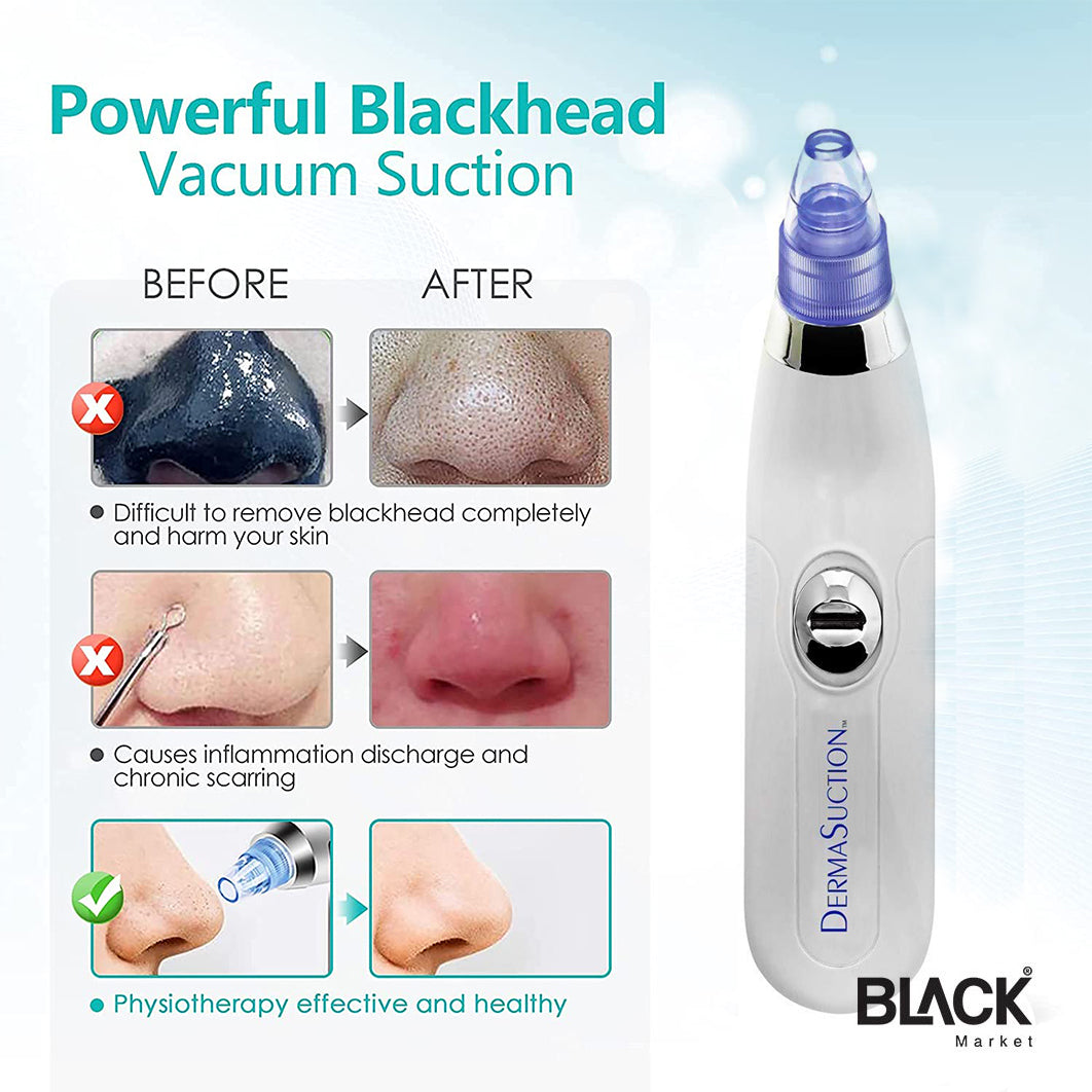 Blackhead Removal Machine 6 In 1 Rechargeable Machine - Trendy Crate Pk