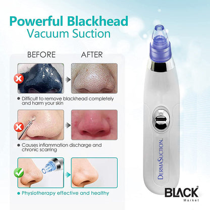 Blackhead Removal Machine 6 In 1 Rechargeable Machine - Trendy Crate Pk