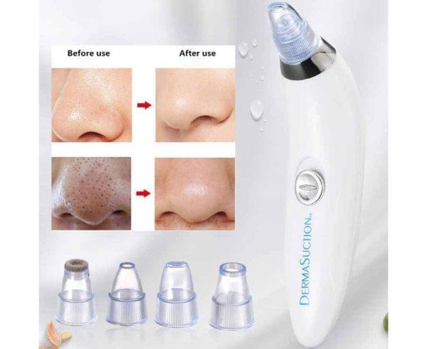 Blackhead Removal Machine 6 In 1 Rechargeable Machine - Trendy Crate Pk