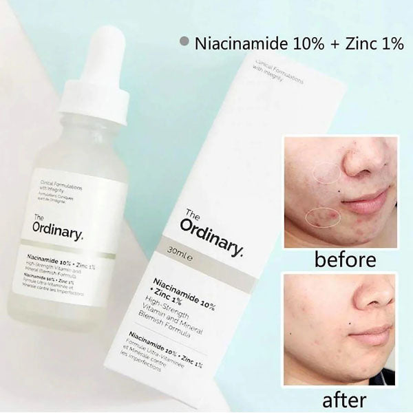THE ORDINARY NIACINAMIDE 10%+ZINC 1%(Original Barcode scan) - Trendy Crate Pk
