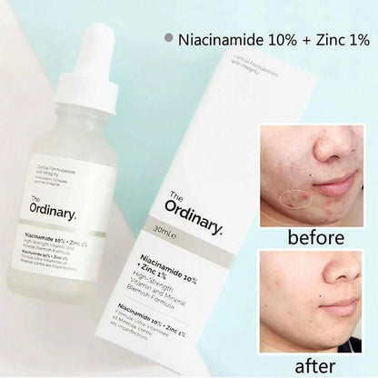THE ORDINARY NIACINAMIDE 10%+ZINC 1%(Original Barcode scan) - Trendy Crate Pk