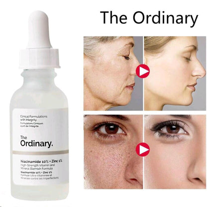 THE ORDINARY NIACINAMIDE 10%+ZINC 1%(Original Barcode scan) - Trendy Crate Pk