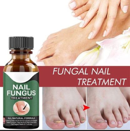 Foot Cure Nail Fungus Treatment – Natural Antifungal Oil for Damaged Nails - Trendy Crate Pk
